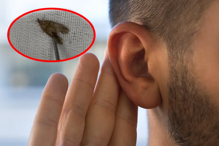 Kulaktan kelebek çıkması