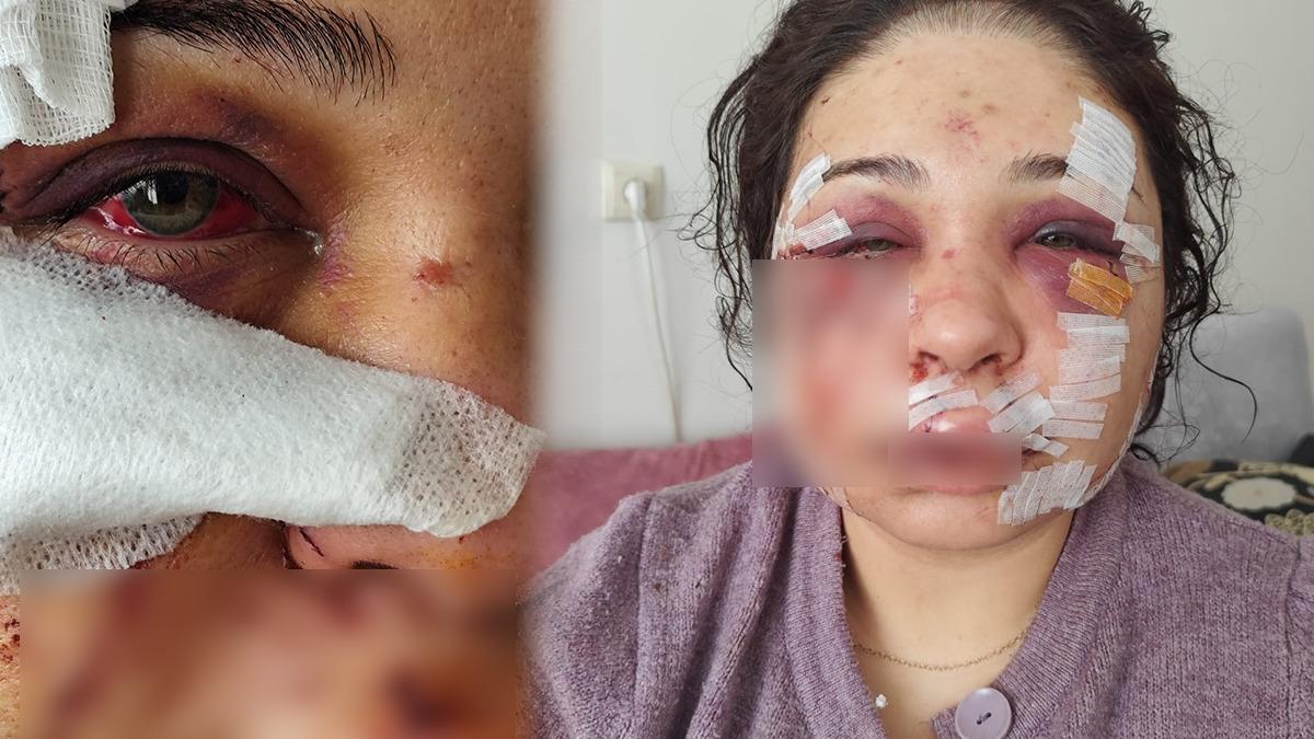 Polis Eşi Yüz Kesme