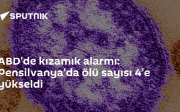 kızamık