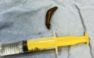 sülük